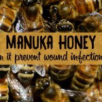 Manuka honey for wounds - can manuka honey heal wounds?