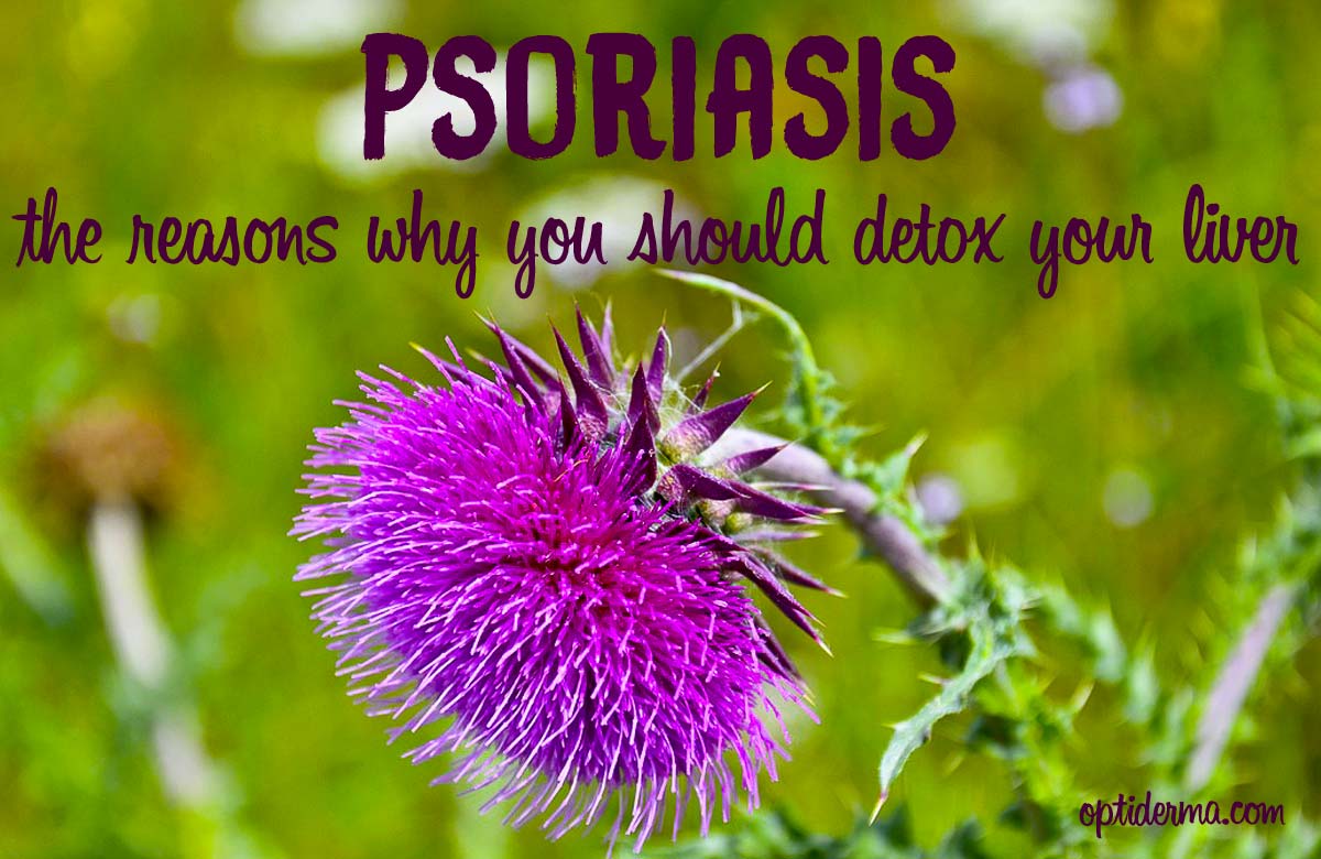 The Reasons Why You Should Detox Your Liver - Milk Thistle for Psoriasis