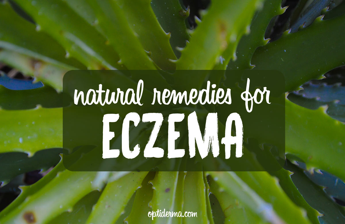 Natural Remedies for Eczema