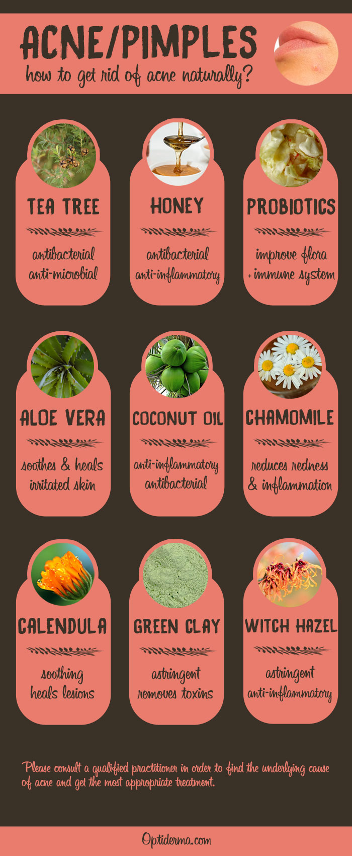 Natural Remedies for Acne - Infographic