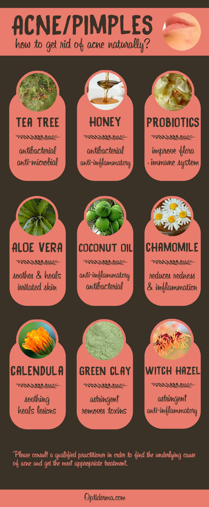 Natural Remedies for Acne - Infographic Natural Remedies for Acne - Infographic