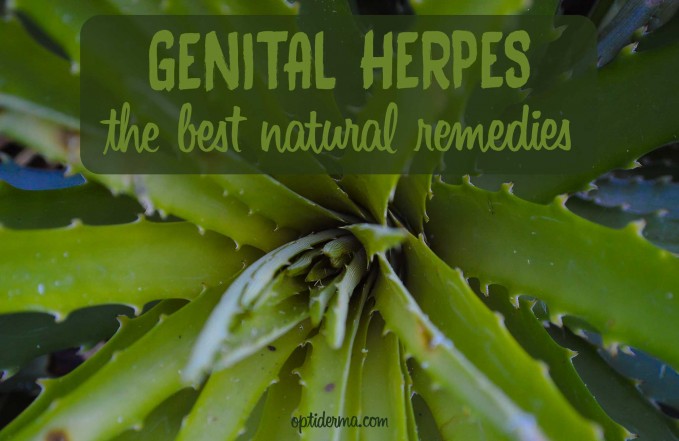 genital herpes natural remedies