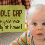 Oil remedy for cradle cap