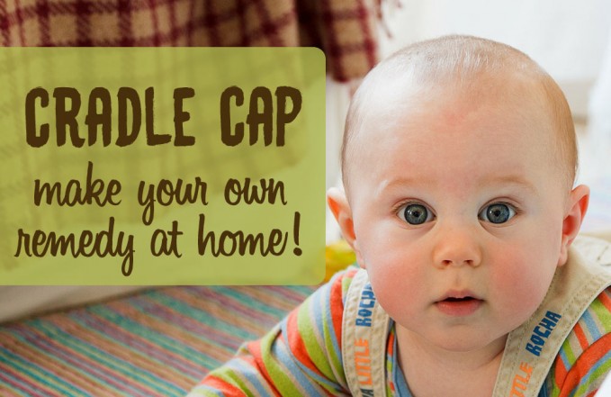 Oil remedy for cradle cap