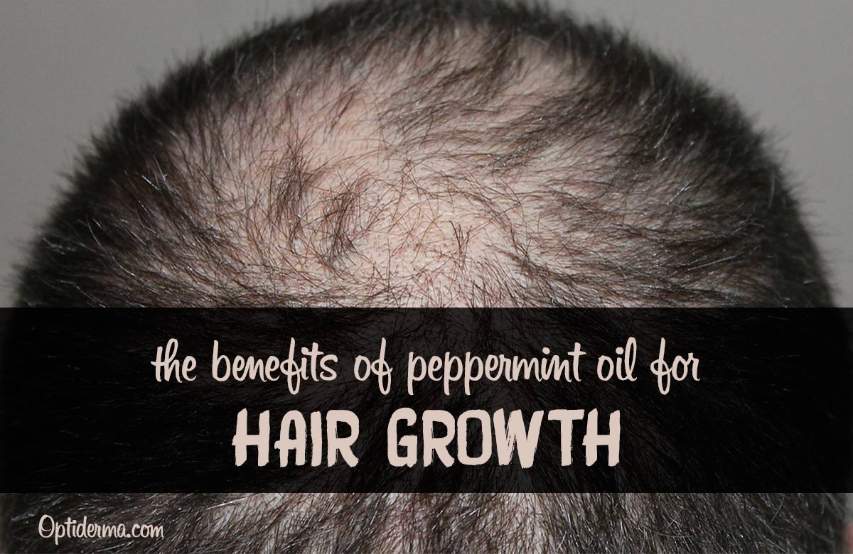 Peppermint Oil for Hair Loss: A Powerful Treatment to Encourage Hair Growth