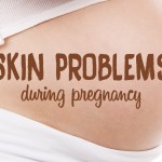 Skin problems during pregnancy