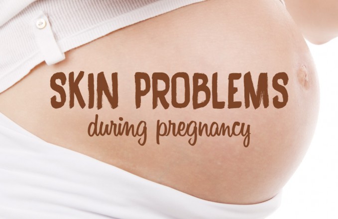 Skin problems during pregnancy