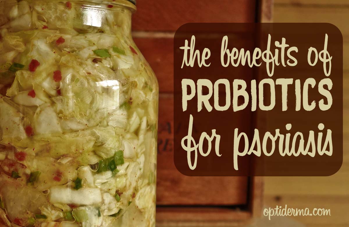 Probiotics for Psoriasis