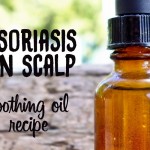 Psoriasis on scalp soothing oil recipe
