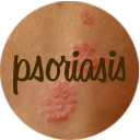 Natural Remedies for Psoriasis Natural Remedies for Psoriasis