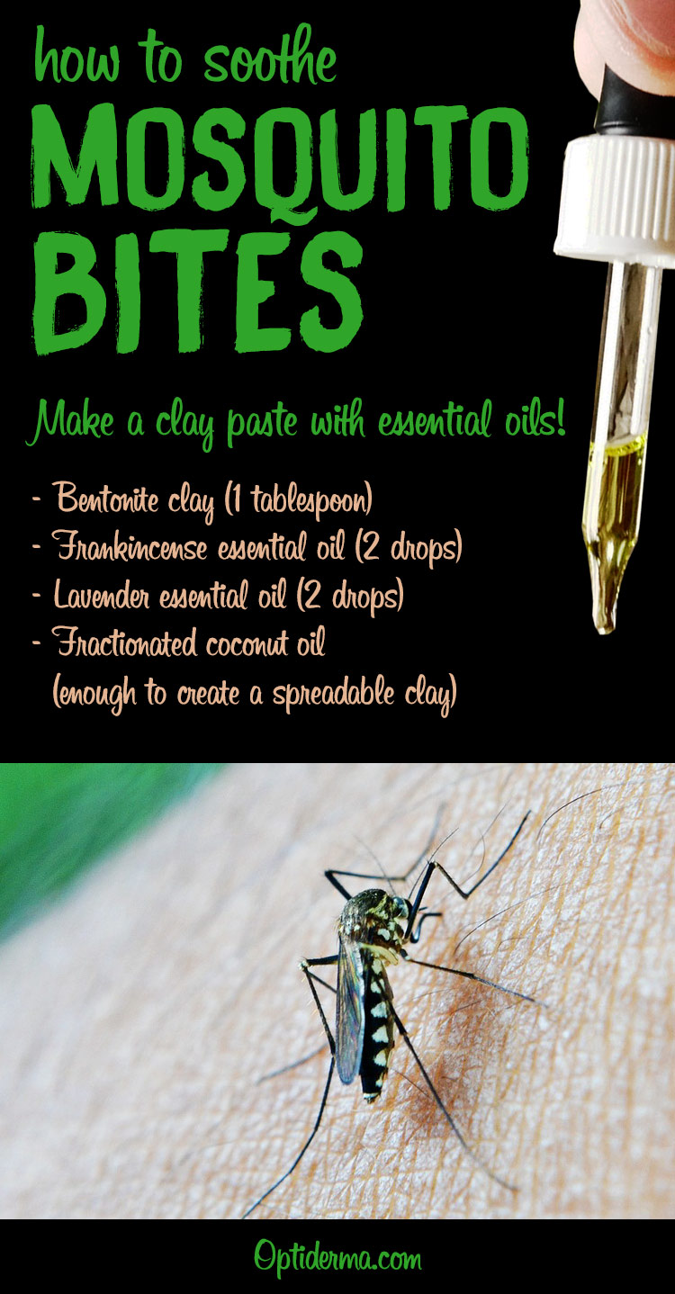 Soothing Clay Paste for Mosquito Bites with Lavender Essential Oil - Homemade Recipe