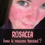 rosacea treatment