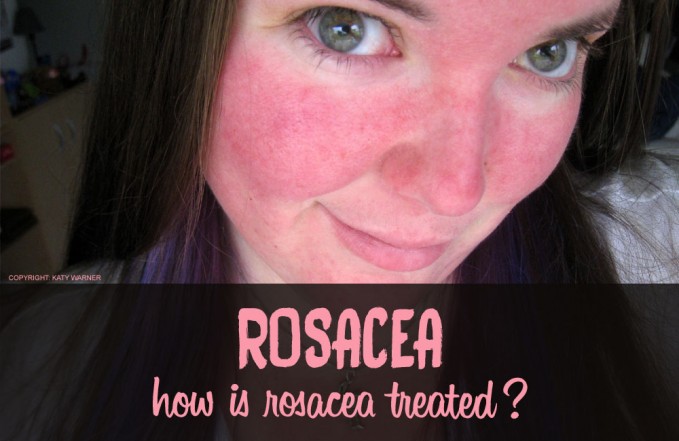 rosacea treatment