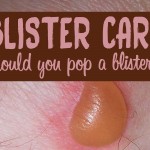 Blister care: should you pop a blister?
