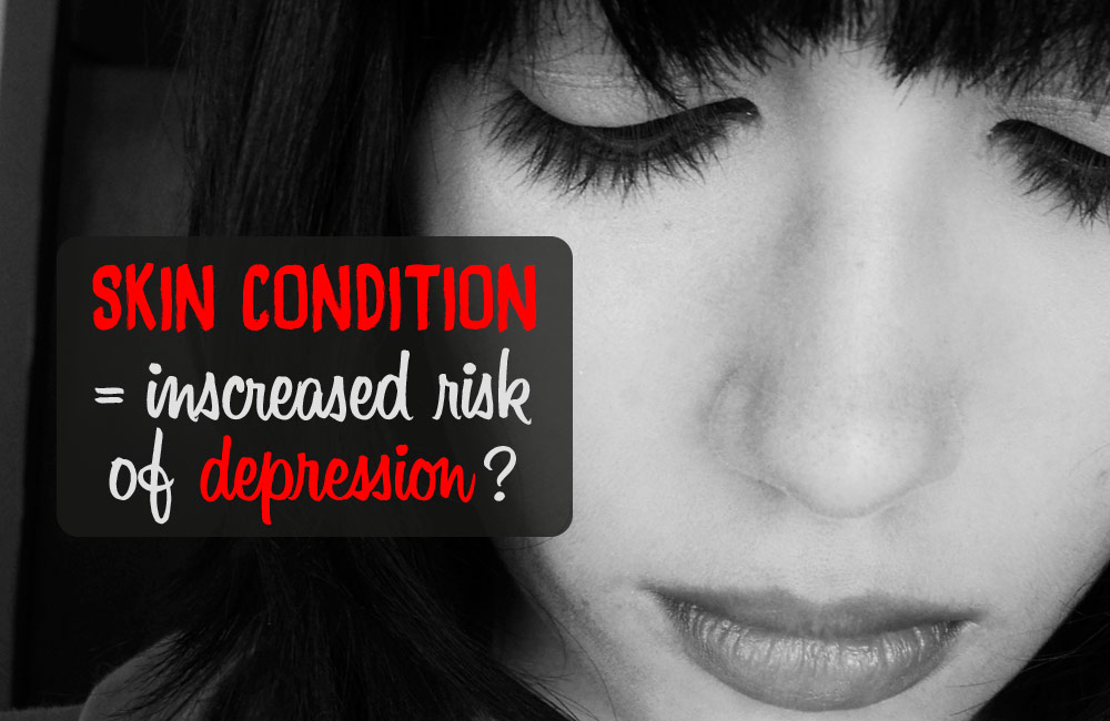 Psoriasis associated with depression and suicidal feelings - Optiderma