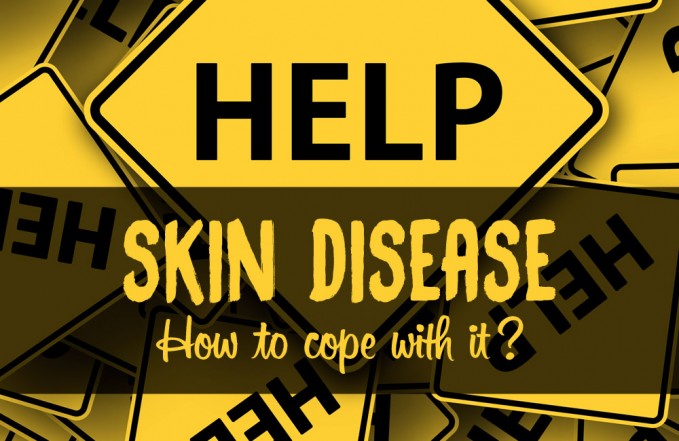 chronic skin disease help