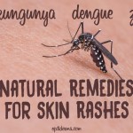 skin rashes caused by zika, chikungunya, dengue