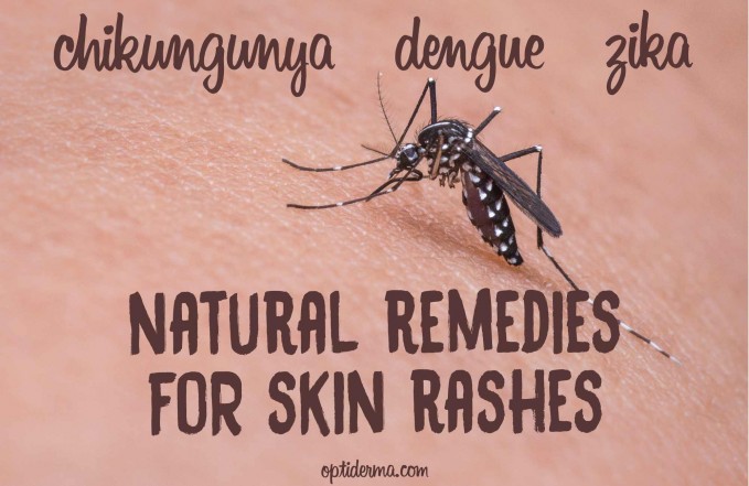 skin rashes caused by zika, chikungunya, dengue