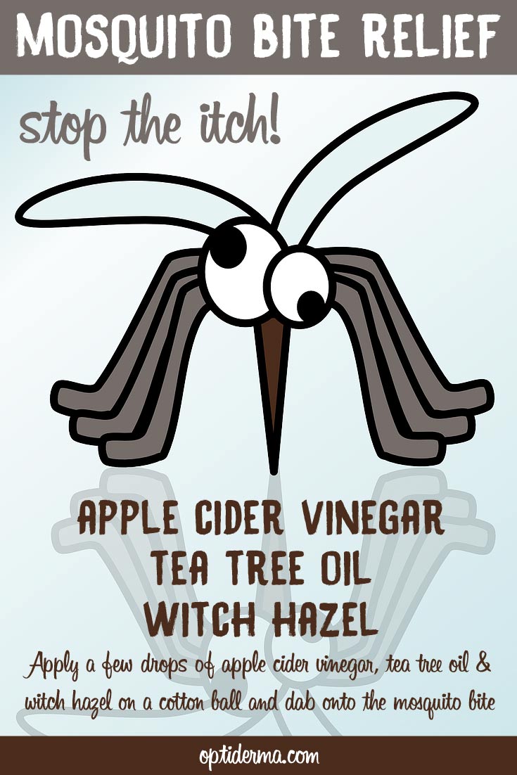 How to stop mosquito bite itch How to stop mosquito bite itch