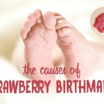 strawberry birthmarks infant