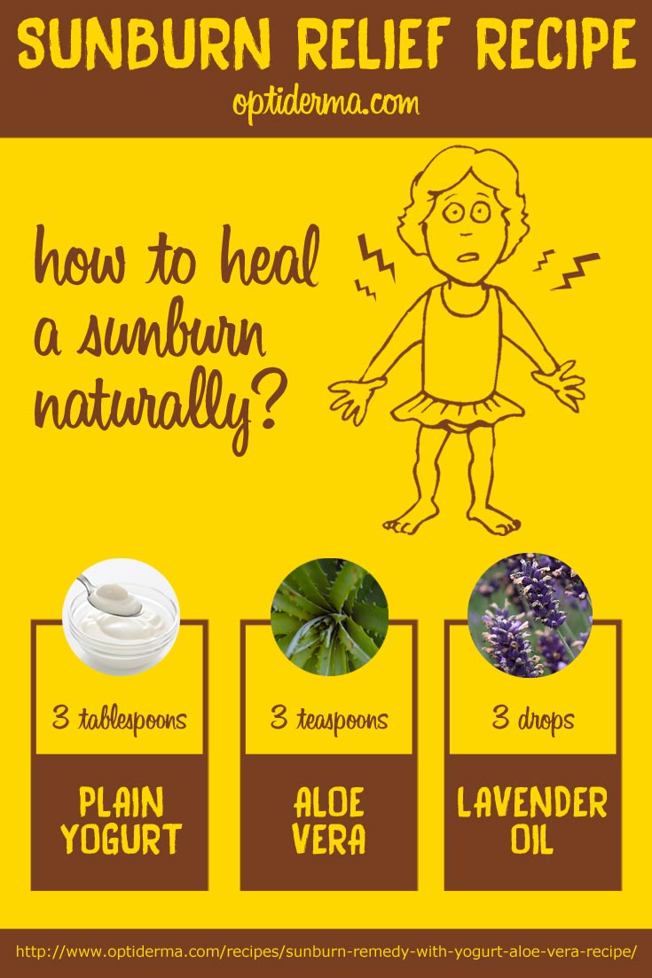 Sunburn Recipe with Aloe Vera, Yogurt & Lavender Oil Sunburn Recipe with Aloe Vera, Yogurt & Lavender Oil