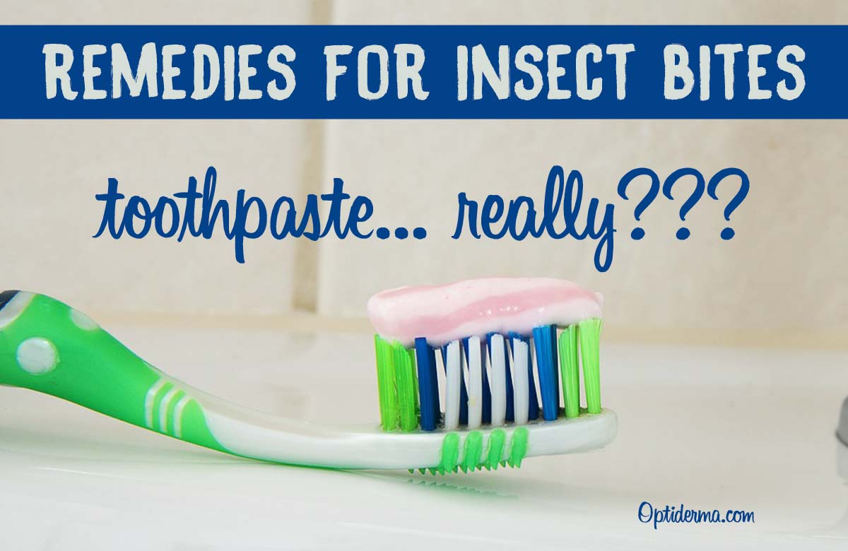 Toothpaste on Bug Bites - Mosquito Bites