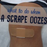 scrape oozes