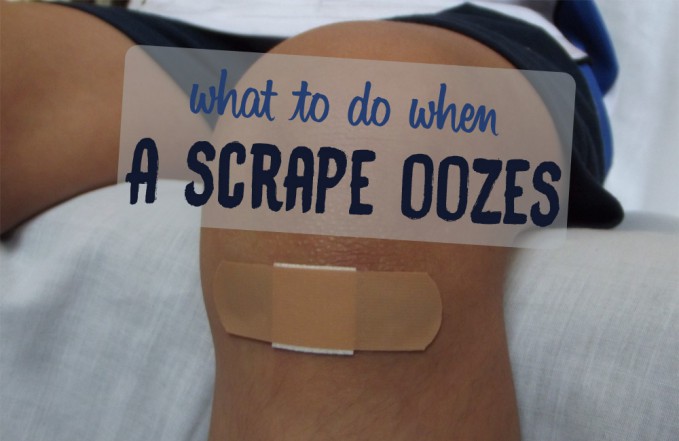 scrape oozes