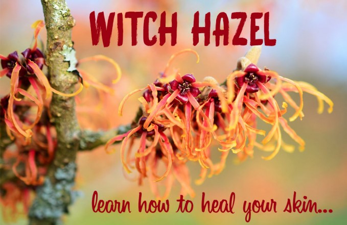 witch hazel for psoriasis & eczema