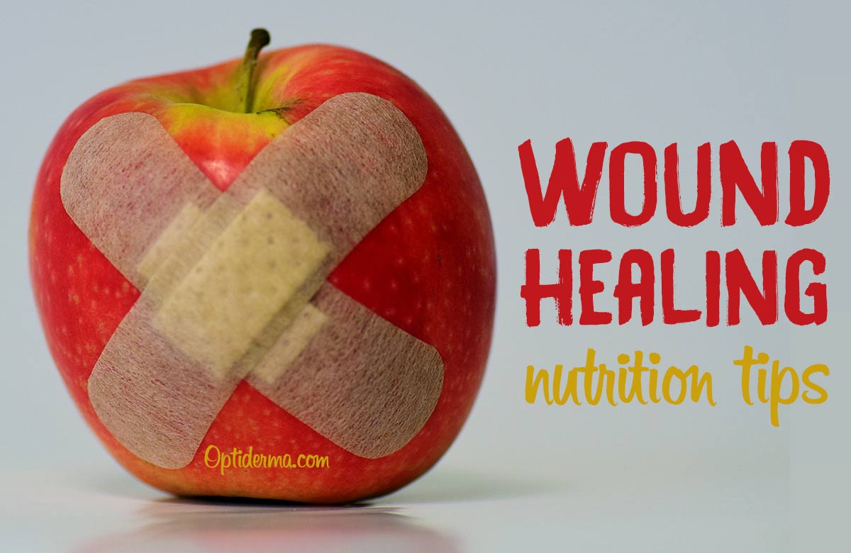 Nutrition for Wound Healing: The Best Foods & Supplements for Wounds