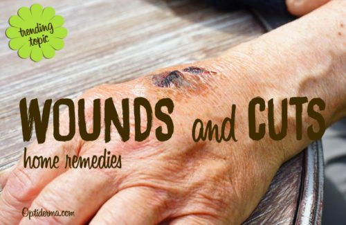 Natural Remedies For Wounds That Won Natural Remedies For Wounds That Won