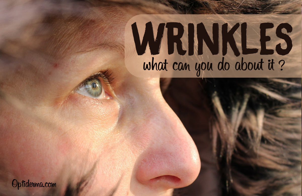 Wrinkles